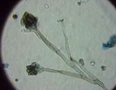 microscopic-mold-mould-fungi-mildew-hyphae-stalks-spores